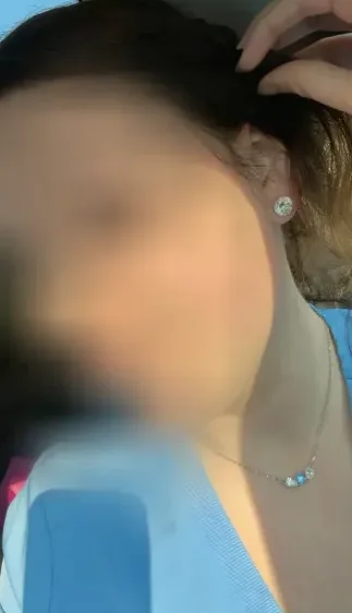 Hanna, 29